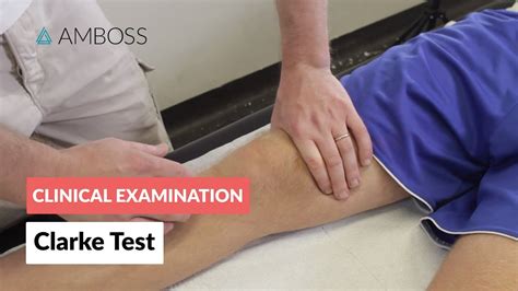 clarke compression tester|clarke's knee test.